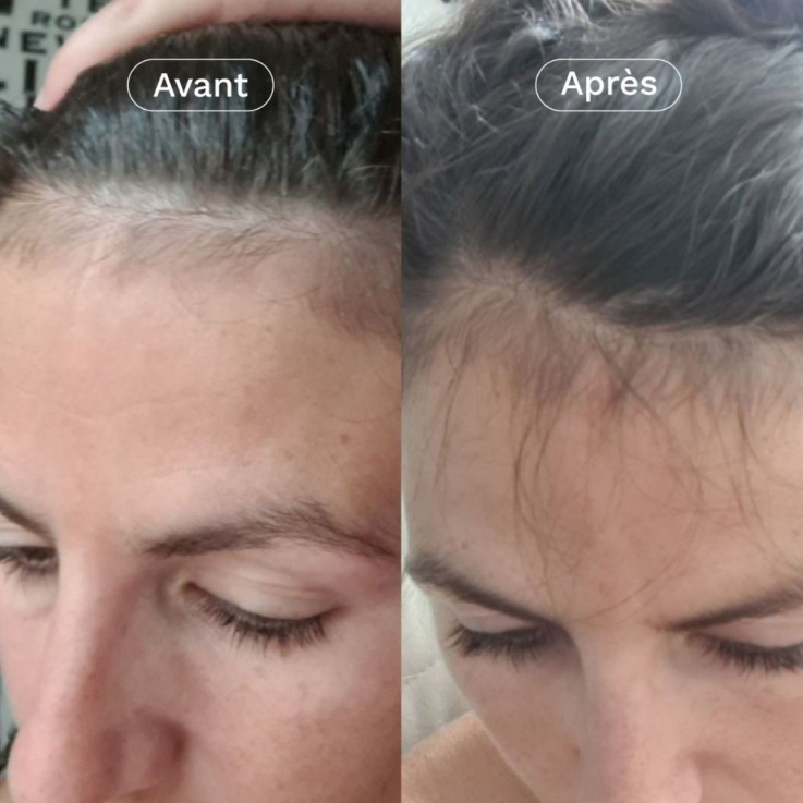 Coffret Cadeau Cheveux Omum & Chou² : 1 Chouchou satin offert + 1 Shampoing Douceur + 1 Complément Pousse