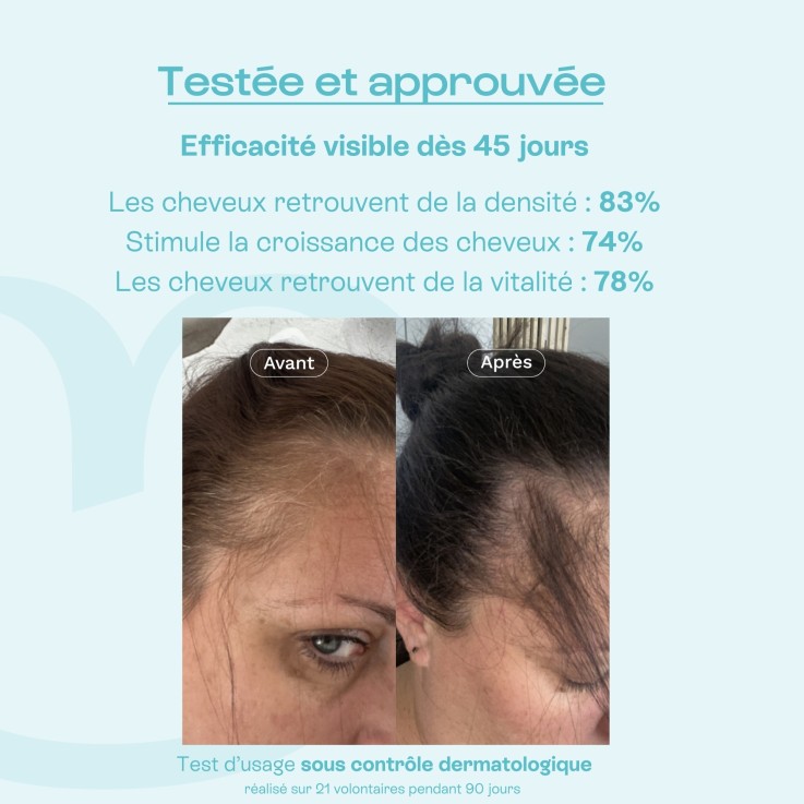 Duo In & Out anti chute cheveux renfort & pousse (60 gélules)