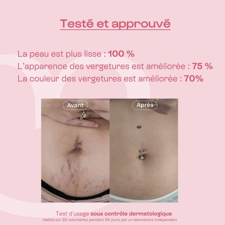 Concentré correcteur vergetures L'Expert (100 ml) Bio