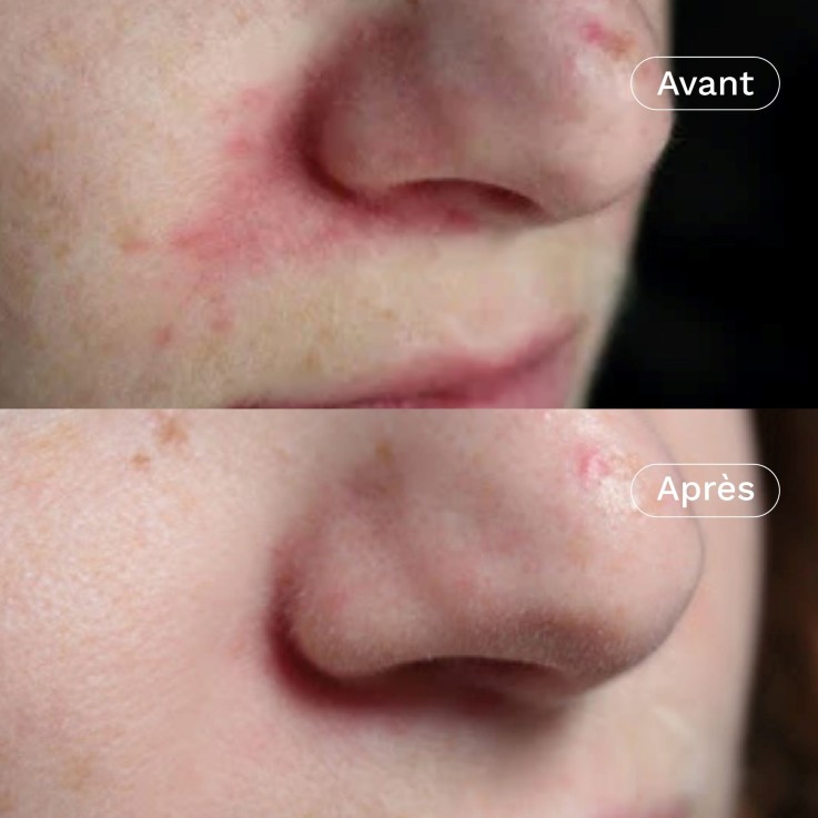 Crème visage rééquilibrante & hydratante aux prébiotiques Ma Jolie Peau (40 ml) Bio