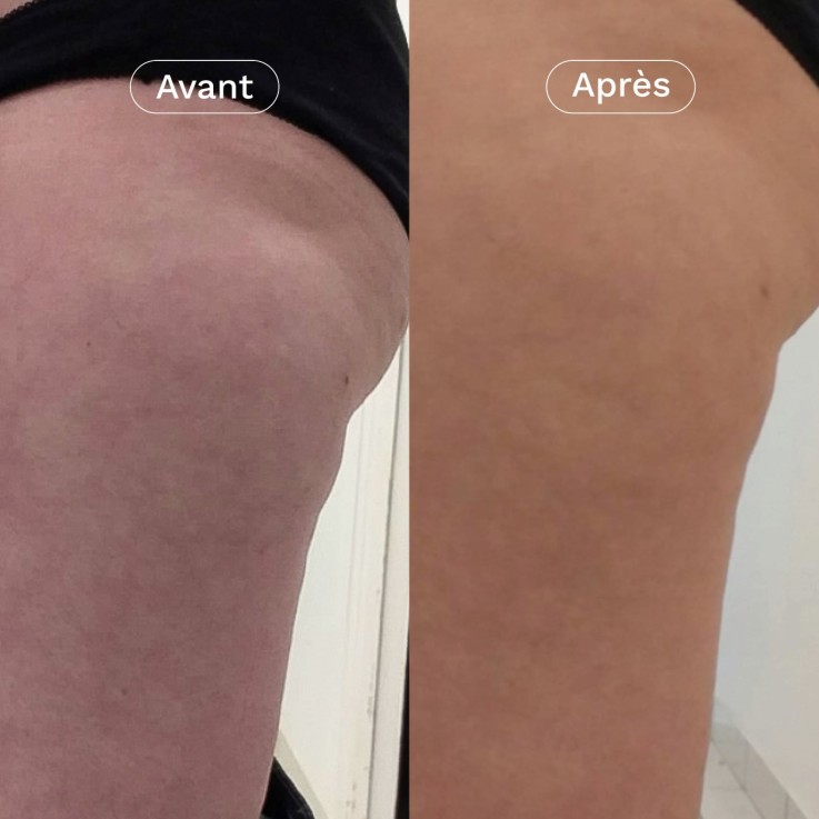 Coffret Duo In and Out Minceur cellulite fermeté Bio