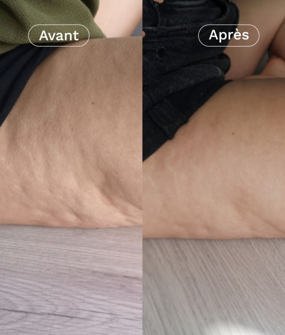 Complément alimentaire...