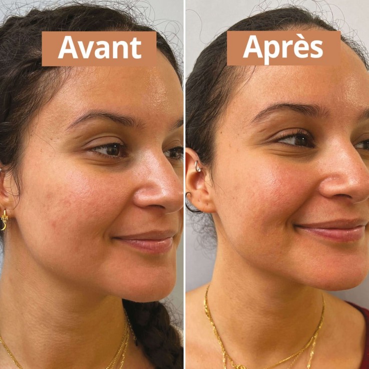 Coffret Routine soin peaux sèches Bio