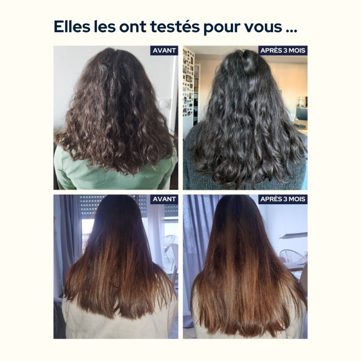 Gummies Cheveux & Ongles sans sucres (60 gummies) Vegan