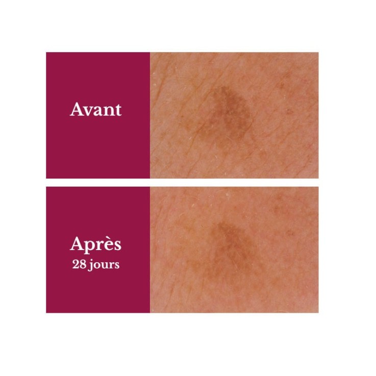Sérum concentré anti-taches (15ml) Bio