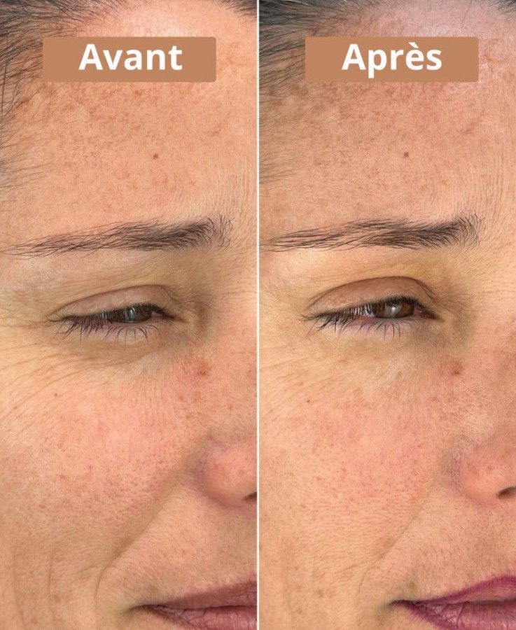 Sérum Contour des yeux Bio & Vegan (10ml)